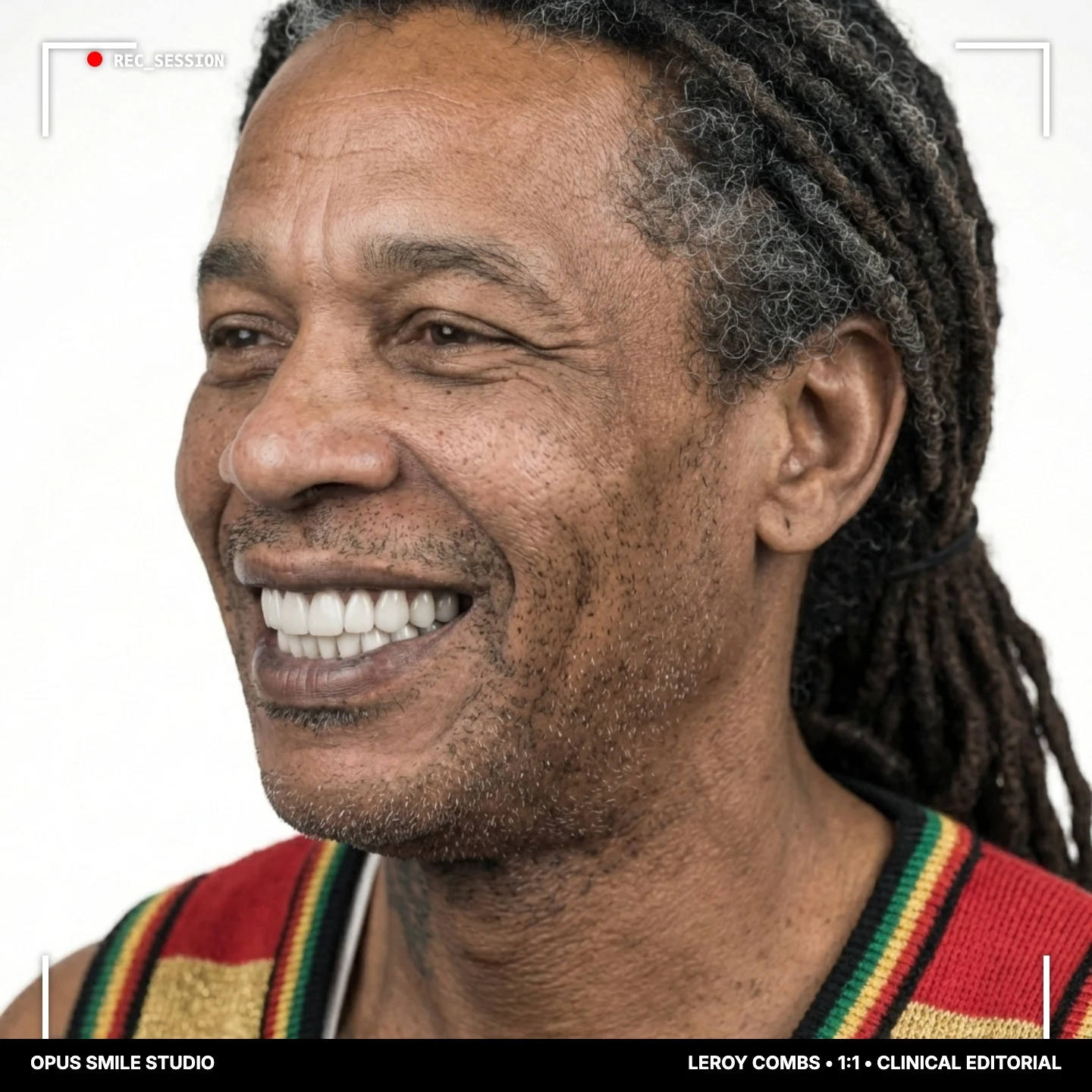 Leroy after 