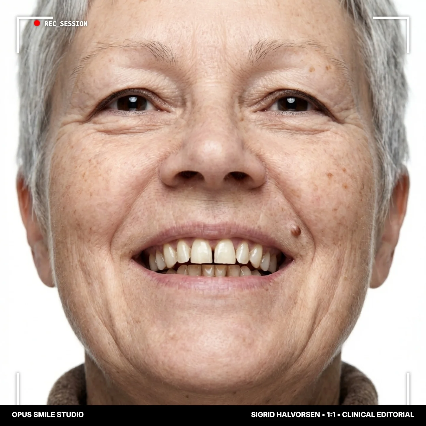 Sigrid before treatment