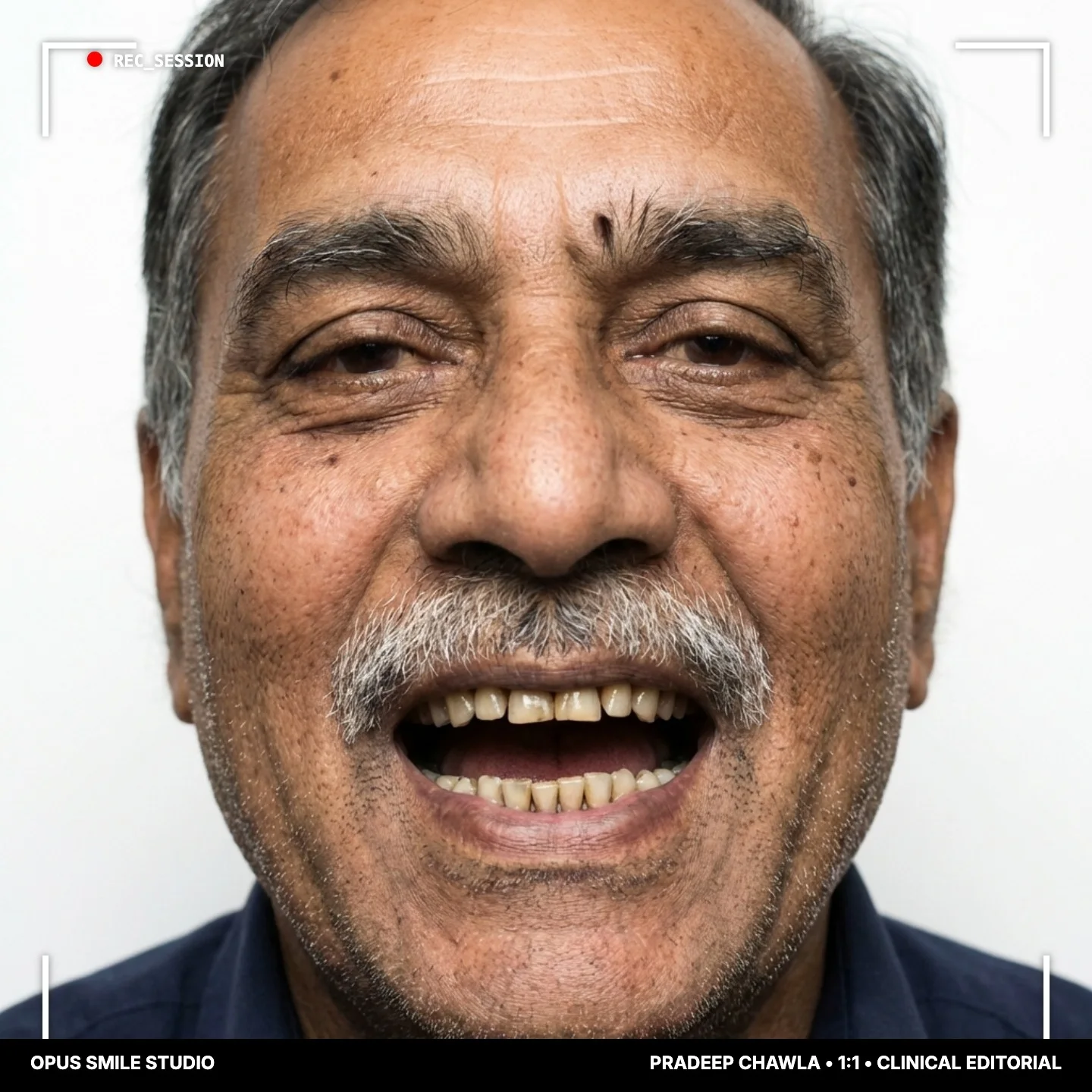 Pradeep - imagen 1